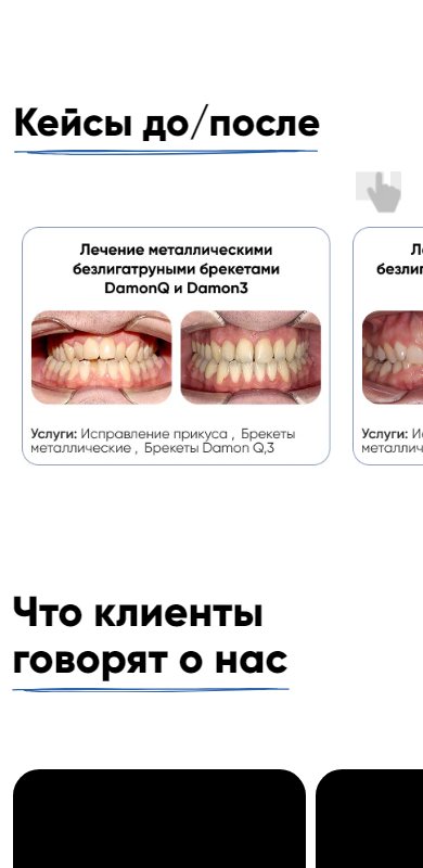 Кейсы до и после на телефоне